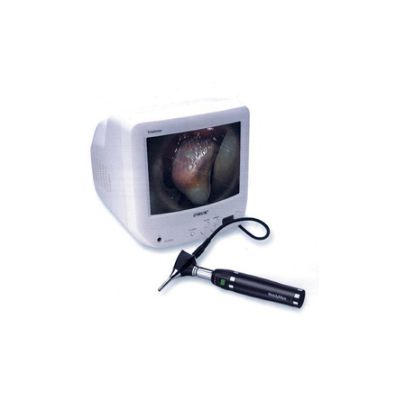 Welch Allyn 15 " monitor f�r video otoskop