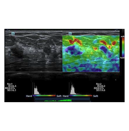 Elastografi f�r M9  L12-4s o L14-6Ns probe