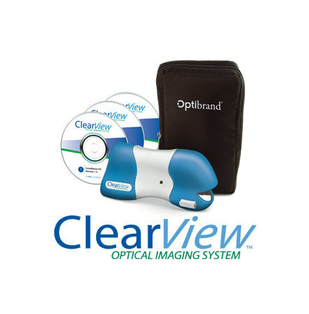 Clearview Digital Fundus Camera